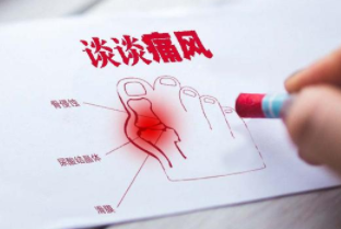 成都西部痛风风湿医院